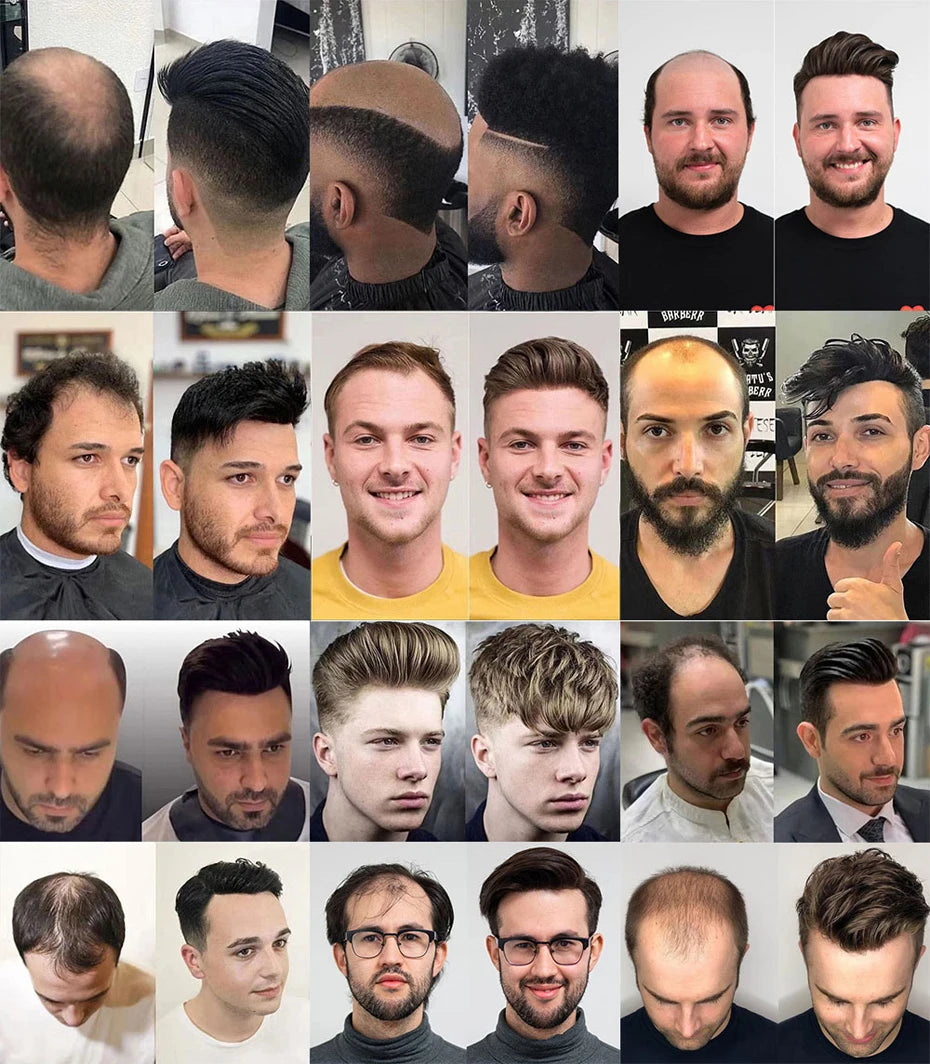 Thin Skin Full PU Toupee for Men – Natural Hairline Remy Hair System