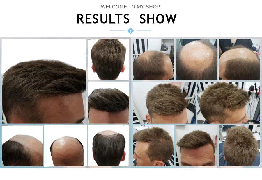 Thin Skin Full PU Toupee for Men – Natural Hairline Remy Hair System