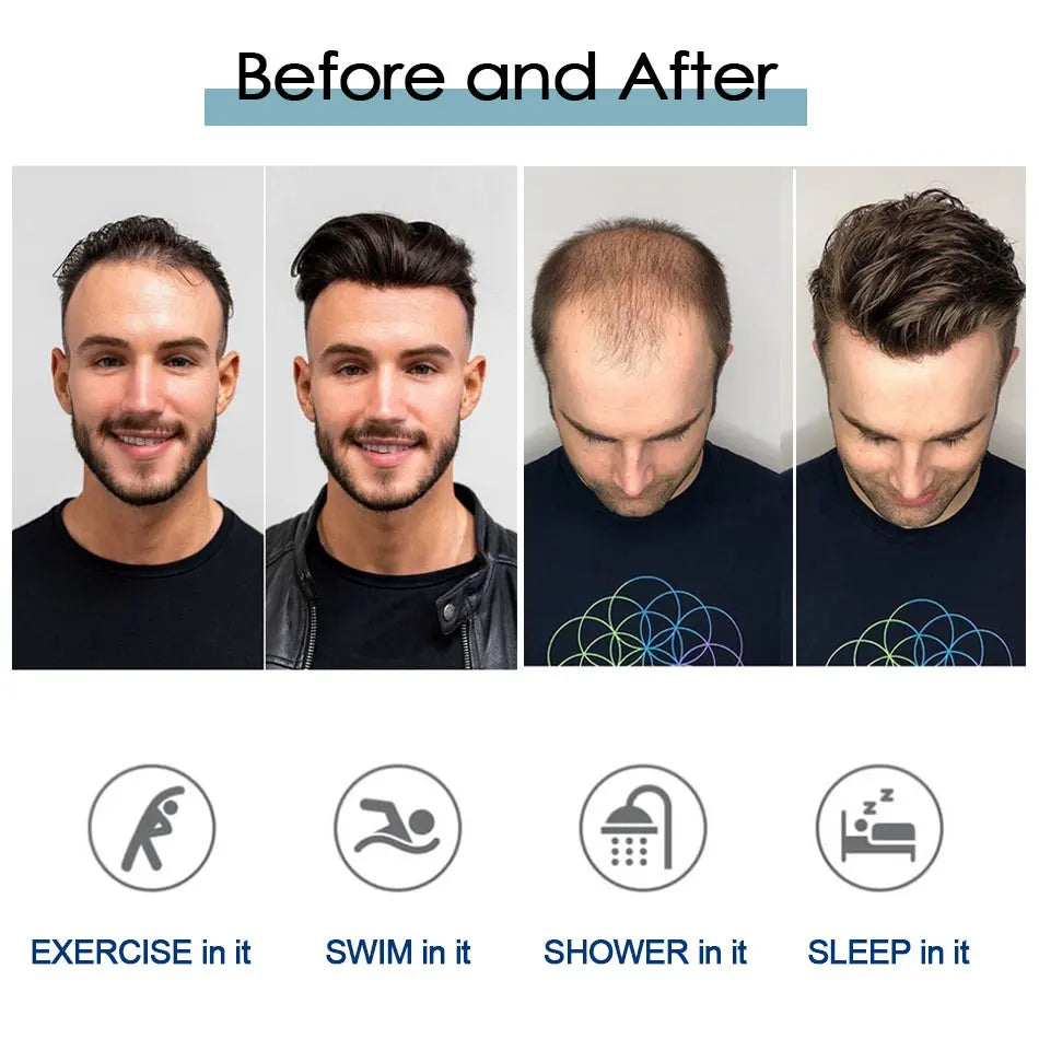 Men's Fine Mono Toupee – 6" Human Hair Wig for Natural Hair Replacement
